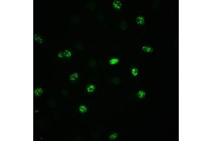 Immunofluorescence staining of A549 cells(treated with 100 ng/mL EGF for 20 min) with ABIN7127690 at 1:100,counter-stained with DAPI. (Rekombinanter EIF2S1 Antikörper  (pSer51))
