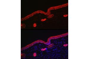 Immunofluorescence analysis of rat skin using Cytokeratin 16 (KRT16) Rabbit pAb (ABIN6129541, ABIN6143021, ABIN6143022 and ABIN6223391) at dilution of 1:200 (40x lens).