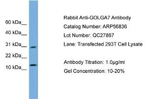 WB Suggested Anti-GOLGA7  Antibody Titration: 0. (Golgin A7 Antikörper  (N-Term))