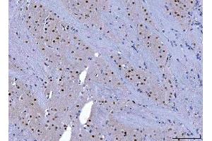 IHC analysis of CHD1 using anti-CHD1 antibody (ABIN7602361). (CHD1 Antikörper  (AA 71-1250))