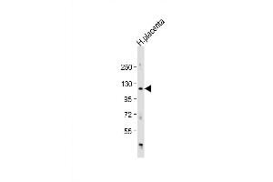 Western Blot at 1:1000 dilution + human placenta lysate Lysates/proteins at 20 ug per lane. (ADAM19 Antikörper  (AA 207-236))