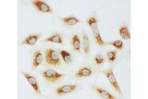 ICC testing of Cytochrome C antibody and A549 cells (Cytochrome C Antikörper  (AA 91-105))