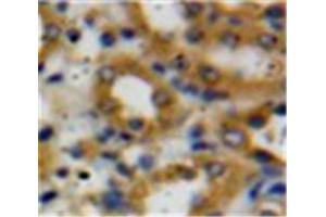 Used in DAB staining on fromalin fixed paraffin-embedded Kidney tissue (Decorin Antikörper  (AA 31-359))