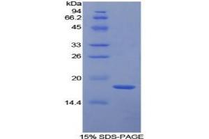 SDS-PAGE analysis of Human TFPI Protein.