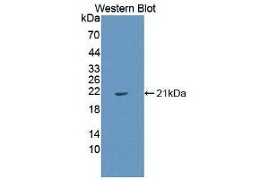 Detection of Recombinant IL1a, Human using Monoclonal Antibody to Interleukin 1 Alpha (IL1a) (IL1A Antikörper  (AA 113-271))
