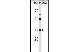 Western blot analysis in NCI-H292 cell line lysates (35ug/lane). (KCTD17 Antikörper  (AA 107-136))