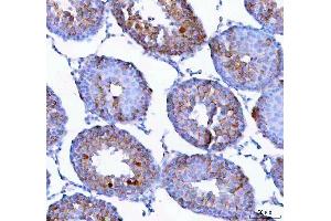 anti-Epithelial Mitogen (EPGN) (AA 19-109) antibody