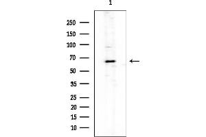 Western blot analysis of lysates from HUVEC cells, using Paxillin Mouse Monoclonal Antibody at 1/1000 dilution.