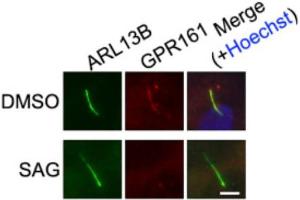 Semi-thin resin sections of the mouse retina were immunolabeled with affinity-purified mouse monoclonal antibody against Arl13b (NeuroMab) (H1,I1), rabbit polyclonal antibody against RIBEYE (U2656) (H2) and rabbit polyclonal antibody against PSD-95 (I2). (ARL13B Antikörper  (C-Term))