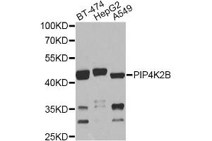 Western blot analysis of extracts of various cell lines, using PIP4K2B antibody. (PIP4K2B Antikörper)