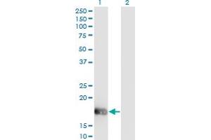 Western Blot analysis of OMP expression in transfected 293T cell line by OMP monoclonal antibody (M01), clone 2B7.