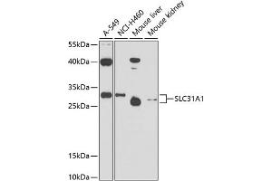 Western blot analysis of extracts of various cell lines, using SLC31 antibody (0109) at 1:1000 dilution. (SLC31A1 Antikörper  (AA 1-60))