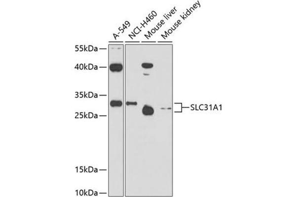 SLC31A1 antibody  (AA 1-60)