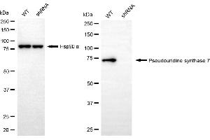 Western blotting analysis using pseudouridine synthase 7 antibody (ABIN7800059). (PUS7 Antikörper)