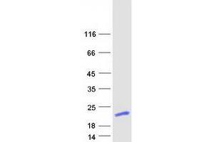 Validation with Western Blot (C17orf62 Protein (Transcript Variant 2) (Myc-DYKDDDDK Tag))
