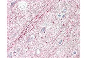 Anti-SLIT1 / SLIT-1 antibody IHC staining of human brain, cortex. (SLIT1 Antikörper  (AA 84-113))