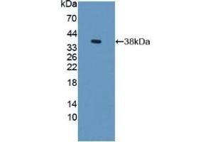 Detection of Recombinant S17aH, Rat using Polyclonal Antibody to Cytochrome P450 17A1 (CYP17A1) (CYP17A1 Antikörper  (AA 201-507))