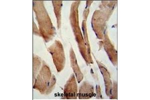 Formalin-fixed and paraffin-embedded human skeletal muscle reacted with CFLAR Antibody (Center), which was peroxidase-conjugated to the secondary antibody, followed by DAB staining. (FLIP Antikörper  (AA 145-174))