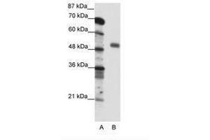 Image no. 1 for anti-Nuclear Transcription Factor Y, gamma (NFYC) (C-Term) antibody (ABIN6736095) (NFYC Antikörper  (C-Term))