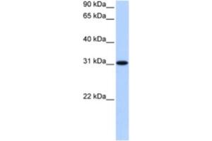 Western Blotting (WB) image for anti-Trinucleotide Repeat Containing 18 (TNRC18) antibody (ABIN2463465) (TNRC18 Antikörper)