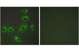 Immunofluorescence analysis of HuvEc cells, using BAX Antibody. (BAX Antikörper  (AA 41-90))