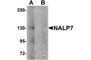 Western blot analysis of NALP7 in human brain tissue lysate with NALP7 antibody at 1 μg/ml in (A) the absence and (B) the presence of blocking peptide. (NLRP7 Antikörper  (N-Term))
