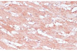 Immunohistochemistry of paraffin-embedded Rat heart using RPL30 Polyclonal Antibody at dilution of 1:100 (40x lens). (RPL30 Antikörper)