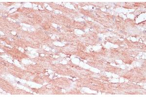 Immunohistochemistry of paraffin-embedded Rat heart using RPL30 Polyclonal Antibody at dilution of 1:100 (40x lens).