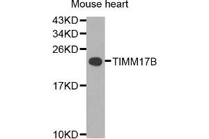 Western blot analysis of extracts of mouse heart cells, using TIMM17B antibody. (TIMM17B Antikörper)