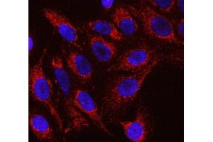 IF analysis of RFTN1 using anti-RFTN1 antibody (ABIN7600344). (RFTN1 Antikörper  (AA 18-437))
