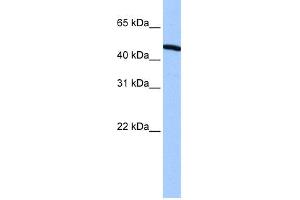 WB Suggested Anti-ZNF514 Antibody Titration:  0. (ZNF514 Antikörper  (N-Term))