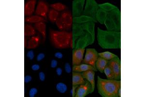 ABIN6258895 and ABIN6274392 staining Hela cells by IF/ICC. (FASTKD1 Antikörper  (Internal Region))