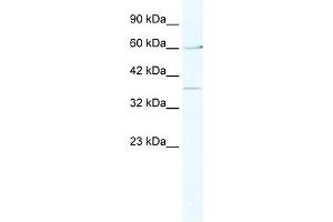 WB Suggested Anti-MTA1 Antibody Titration:  2. (MTA1 Antikörper  (Middle Region))