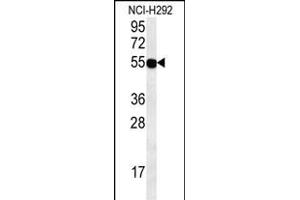 ZN Antibody (C-term) (ABIN654587 and ABIN2844288) western blot analysis in NCI- cell line lysates (35 μg/lane). (ZNF492 Antikörper  (C-Term))