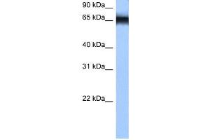 WB Suggested Anti-HNRPM Antibody Titration: 0. (HNRNPM Antikörper  (N-Term))