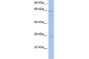 WB Suggested Anti-PRKAA1 Antibody Titration: 0. (PRKAA1 Antikörper  (Middle Region))