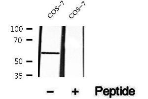 anti-serum/glucocorticoid Regulated Kinase Family, Member 3 (SGK3) (pThr320) antibody