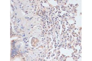 Immunohistochemistry of paraffin-embedded Rat lung using Phospho-STAT1(S727) Polyclonal Antibody at dilution of 1:100 (40x lens).