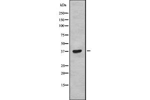 Western blot analysis of TAS2R38 using COLO205 whole cell lysates (TAS2R38 Antikörper  (Internal Region))