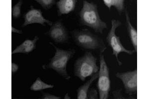 Immunofluorescent staining of HeLa (ATCC CCL-2) cells. (SKP1 Antikörper  (AA 4-158))