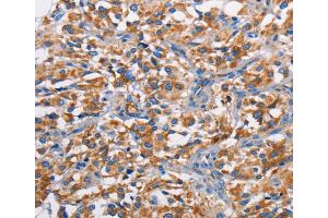 Immunohistochemistry (IHC) image for anti-Proto-Oncogene Pim-2 (Serine Threonine Kinase) (PIM2) antibody (ABIN2422823) (PIM2 Antikörper)