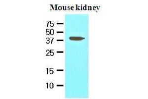 Western Blotting (WB) image for anti-Apoptosis, Caspase Activation Inhibitor (AVEN) (AA 254-362) antibody (ABIN336089) (AVEN Antikörper  (AA 254-362))