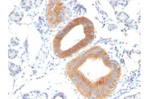 Image no. 1 for anti-CD86 (CD86) antibody (ABIN6185469) (CD86 Antikörper)