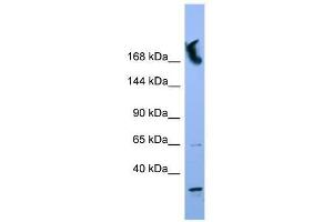 NUP155 antibody used at 0. (NUP155 Antikörper  (N-Term))