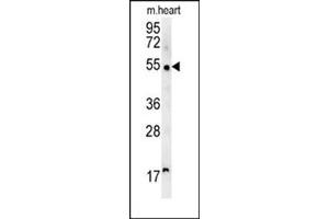Western blot analysis of SCARA5 Antibody (C-term) Cat. (SCARA5 Antikörper  (C-Term))