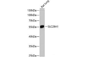 Western blot analysis of extracts of Rat lung using SLC29A1 Polyclonal Antibody at dilution of 1:3000. (SLC29A1 Antikörper)