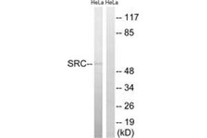 Western blot analysis of extracts from HeLa cells, treated with Hu 2nM 24h, using Src (Ab-75) Antibody. (Src Antikörper  (AA 41-90))