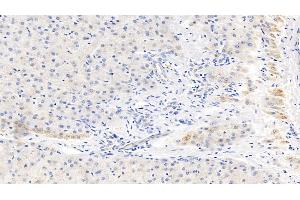 Detection of CRP in Human Liver Tissue using Monoclonal Antibody to C Reactive Protein (CRP) (CRP Antikörper  (AA 17-224))