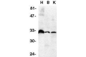 Western blot analysis of DcR3 in human heart (H), brain (B), and kidney (K) tissue lysates with DcR3 antibody at 1μg/ml. (TNFRSF6B Antikörper)
