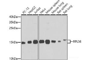 Western blot analysis of extracts of various cell lines using RPL36 Polyclonal Antibody at dilution of 1:1000. (RPL36 Antikörper)